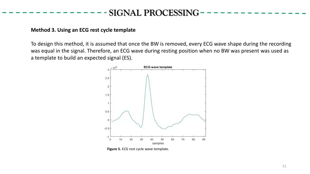 signal processing 2