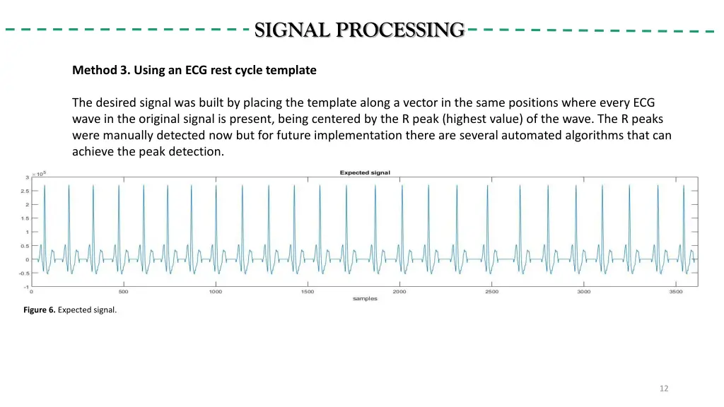 signal processing 3