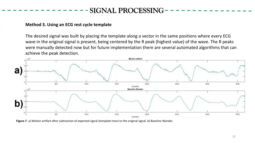 signal processing 4