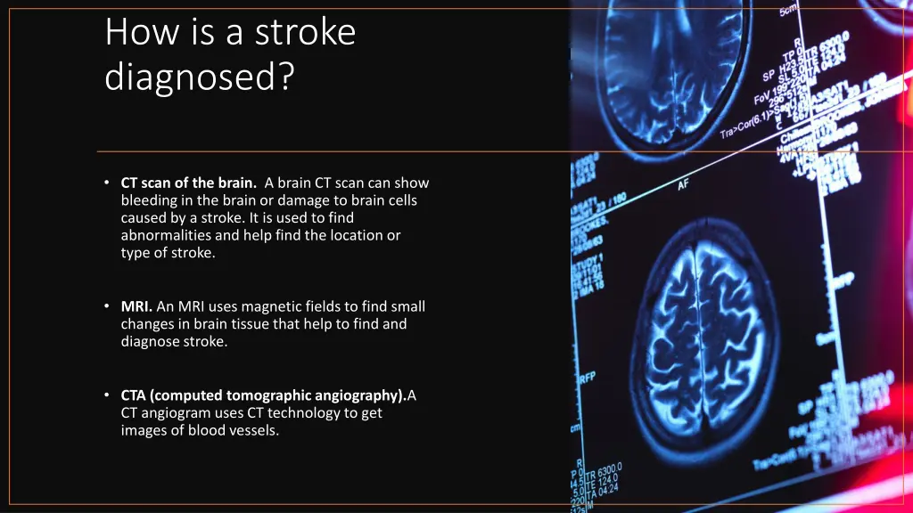 how is a stroke diagnosed