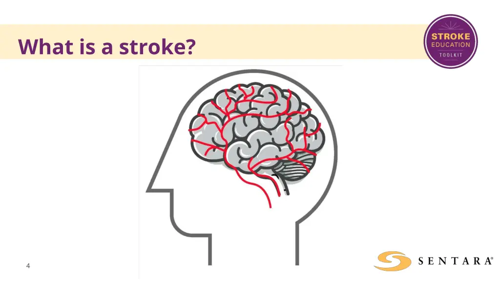 what is a stroke