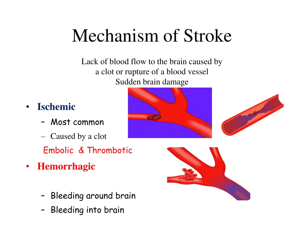 mechanism of stroke 1