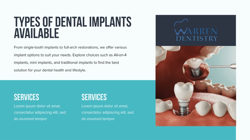 PPT - Dental Implants in Fort Worth - Restore Your Smile with Lasting ...