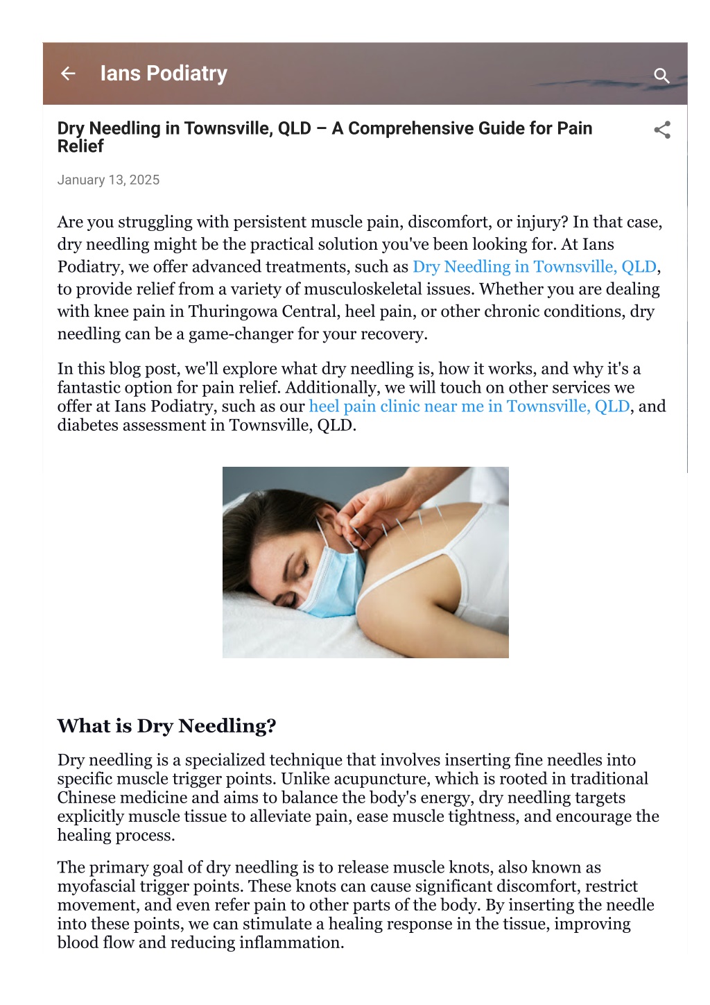 PPT - Dry Needling in Townsville, QLD – A Comprehensive Guide for Pain ...